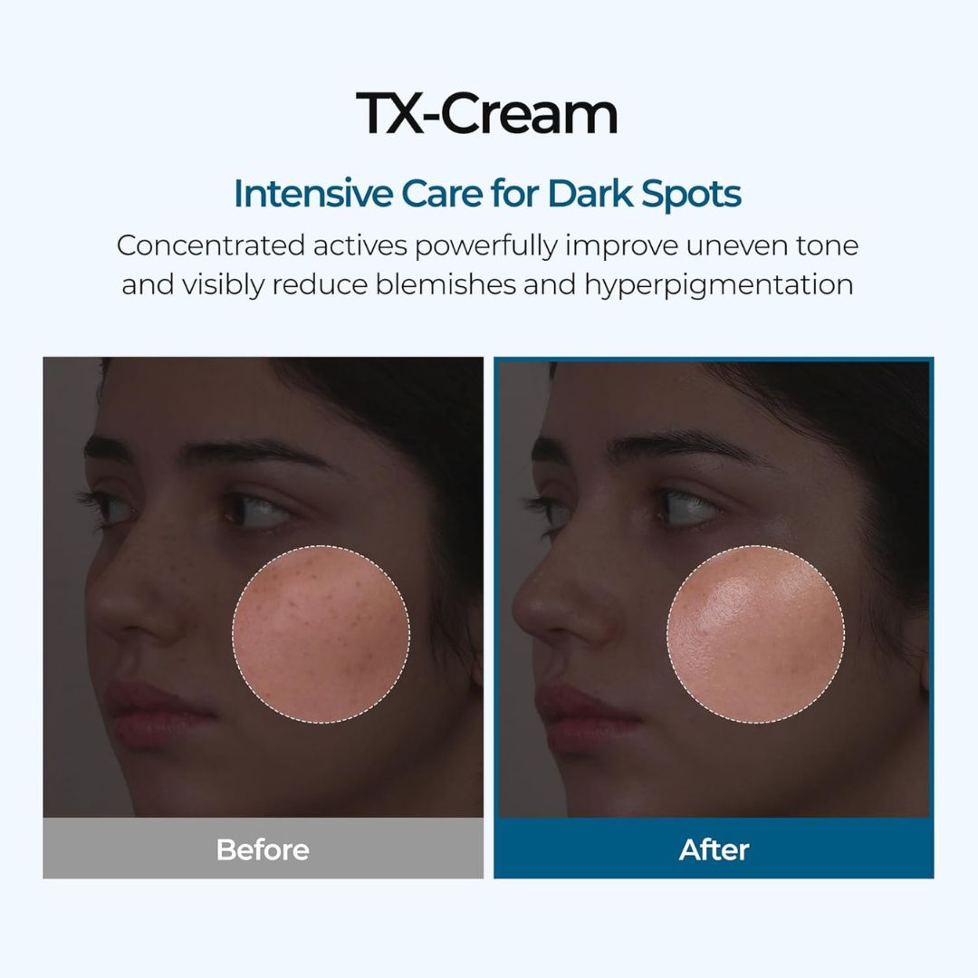 SpotFade™ Brightening Cream