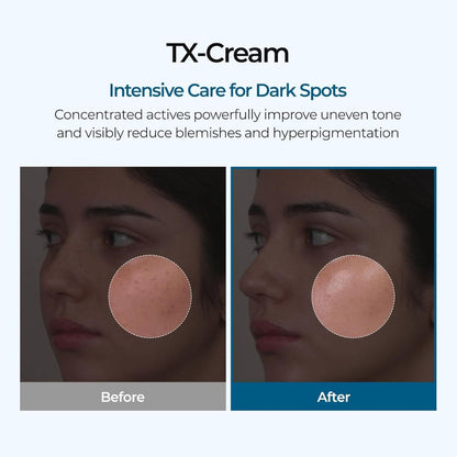 SpotFade™ Brightening Cream
